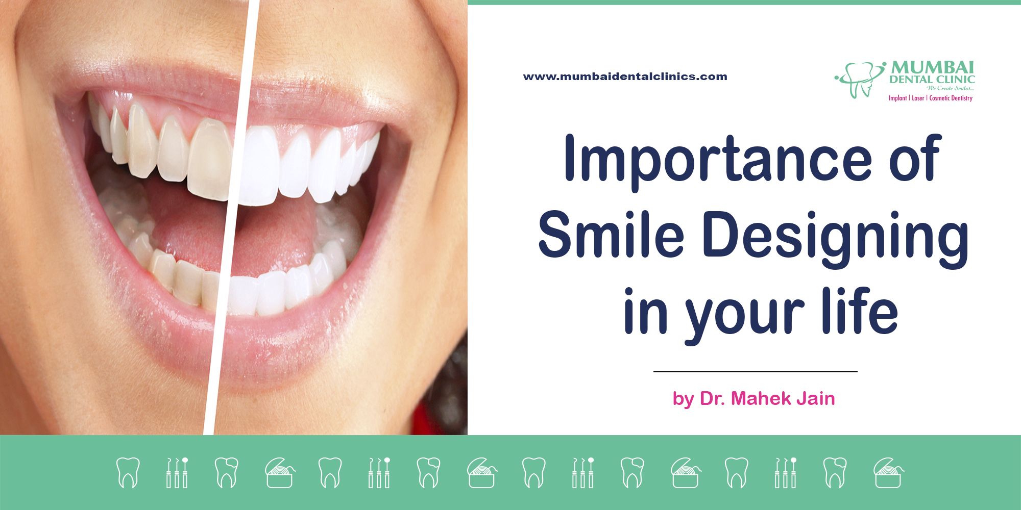 Importance of smile designing in your life, best dentist in udaipur,smile designing treatment in udaipur,Braces specialist in Udaipur,Braces doctor in Udaipur