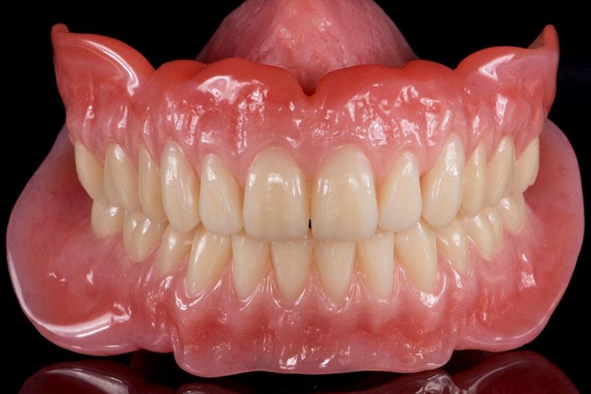 Dentures Doctors in Udaipur