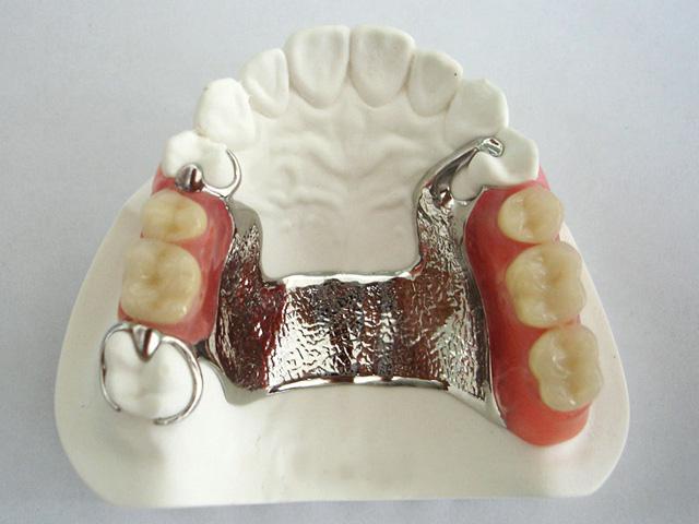 Dental surgeon in udaipur/>
				
				<h3 style=